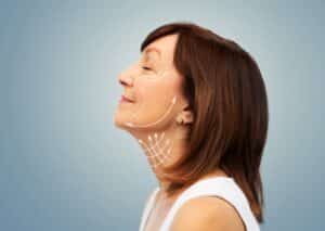 Older woman looking up and showing her profile after receiving a facelift surgery